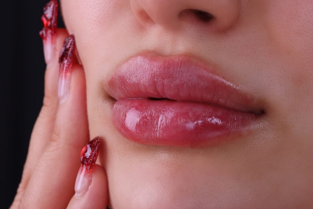 JUVEDERM Sugar Land TX
