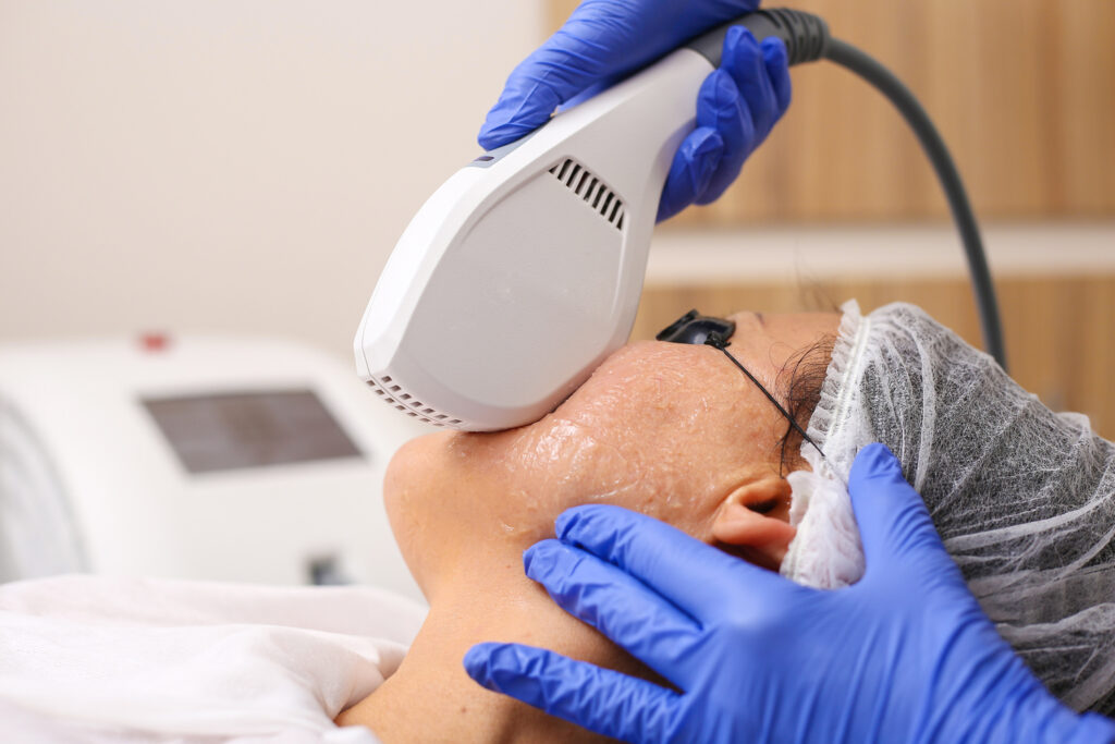 Photo Facial Therapy. Anti-aging Procedures. IPL Treatment Sugar Land TX