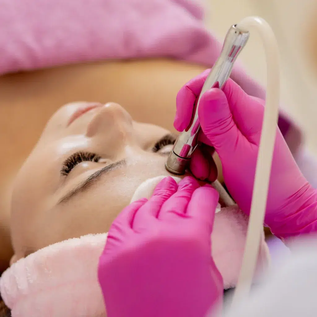 microdermbrasion Top Microdermabrasion Sugar Land TX