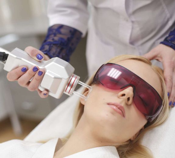 Photofacial Laser Treatment